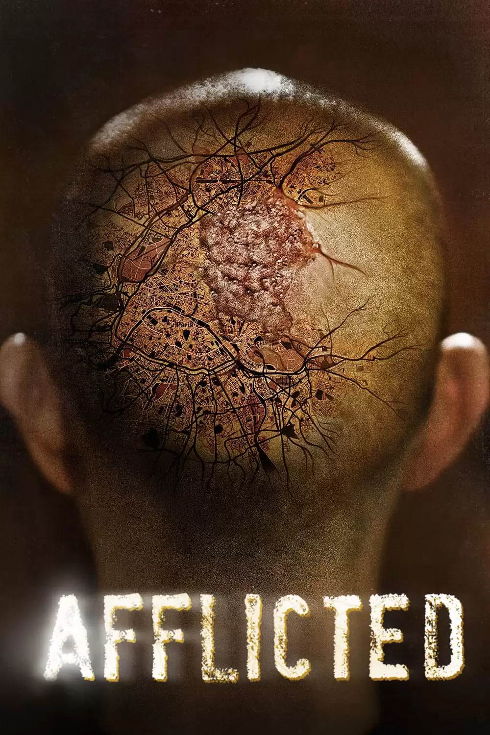 Sức Mạnh Dị Thường | Afflicted (2014)